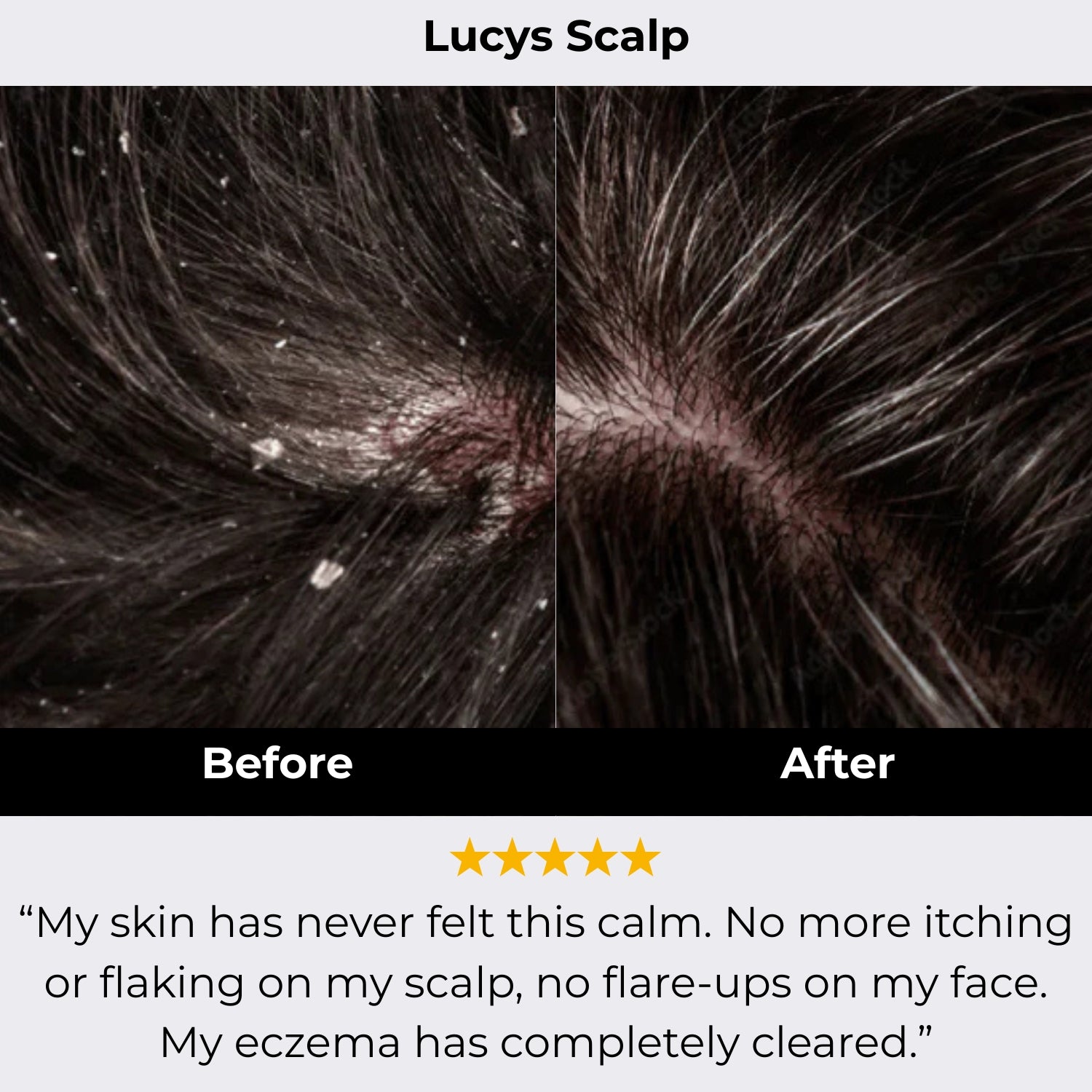 DermaNest Natural Calming Serum